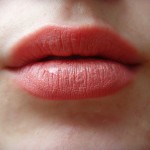 Chapped Lip Treatment